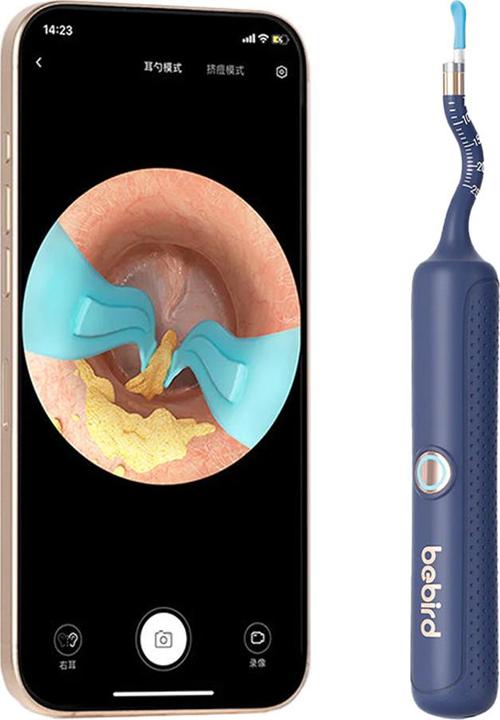 Immagine prodotto Bebird EarSight Plus