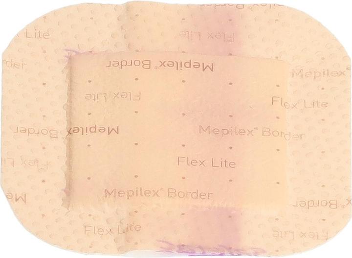 Actual product image Mepilex Border Flex Lite