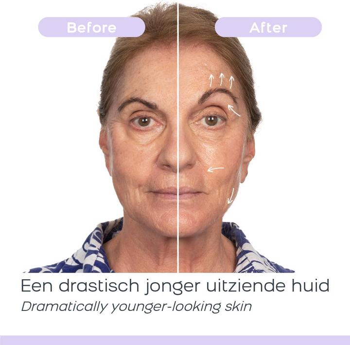 Actual product image DermaWand Skin Care Device Pro version