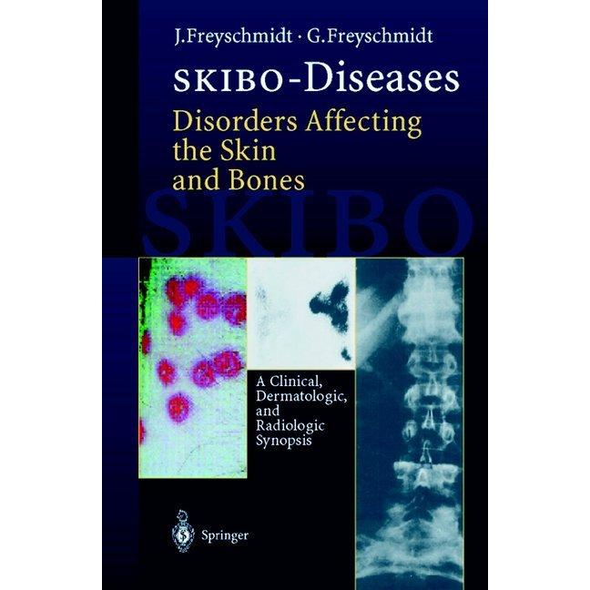 SKIBO-Diseases Disorders Affecting the Skin and Bones, Fachbücher von Jürgen Freyschmidt, Gisela Freyschmidt