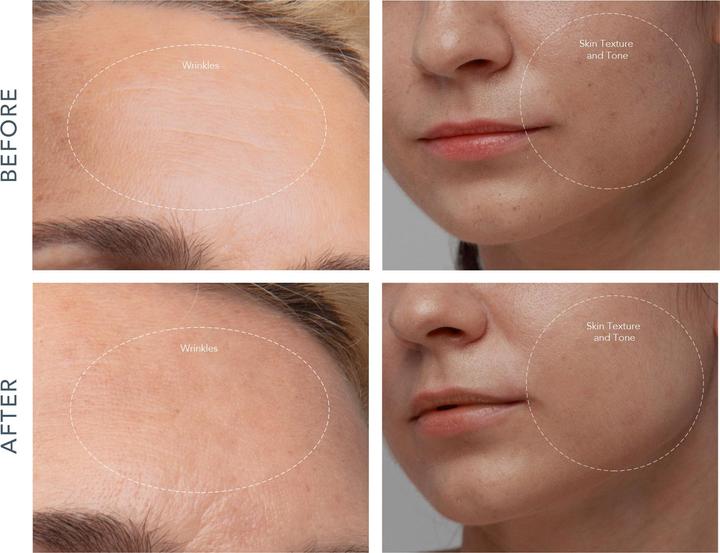 Produktbild Foreo Kiwi Derma