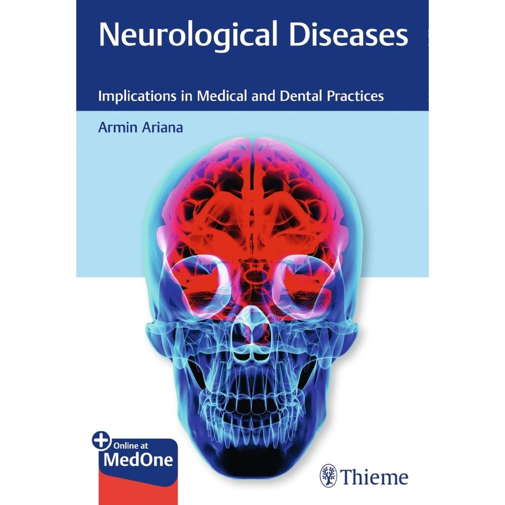 Ariana:Neurological Diseases, Fachbücher von Armin Ariana