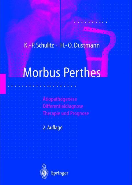 Produktbild Morbus Perthes (Deutsch, Hans-Otto Dustmann, Klaus-Peter Schulitz, 2012)