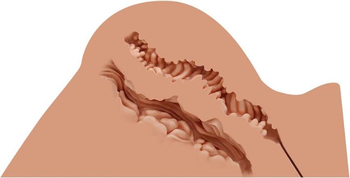 Image du produit Naked Factory Hannah, la fille de la fantaisie