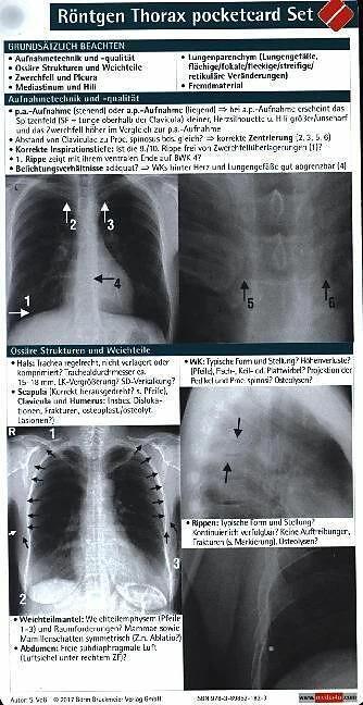 Immagine prodotto Röntgen Thorax pocketcard Set (Tedesco, S. Voss, 2015)