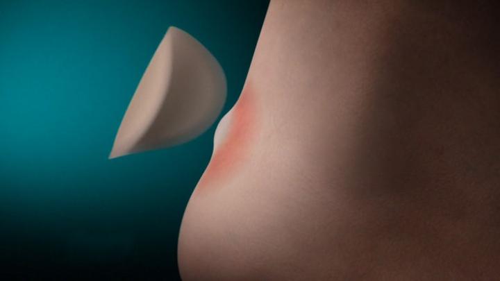 Actual product image Compeed blister plaster (5 x)