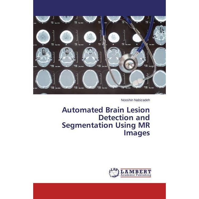 Automated Brain Lesion Detection and Segmentation Using MR Images, Fachbücher von Nooshin Nabizadeh