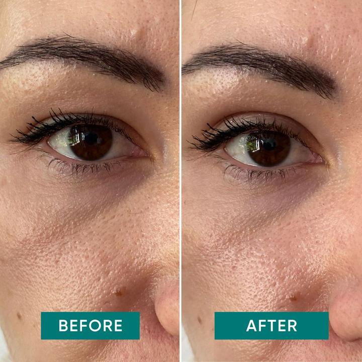 Produktbild Apricot Bye Sleepy Eye (Augenpatches)