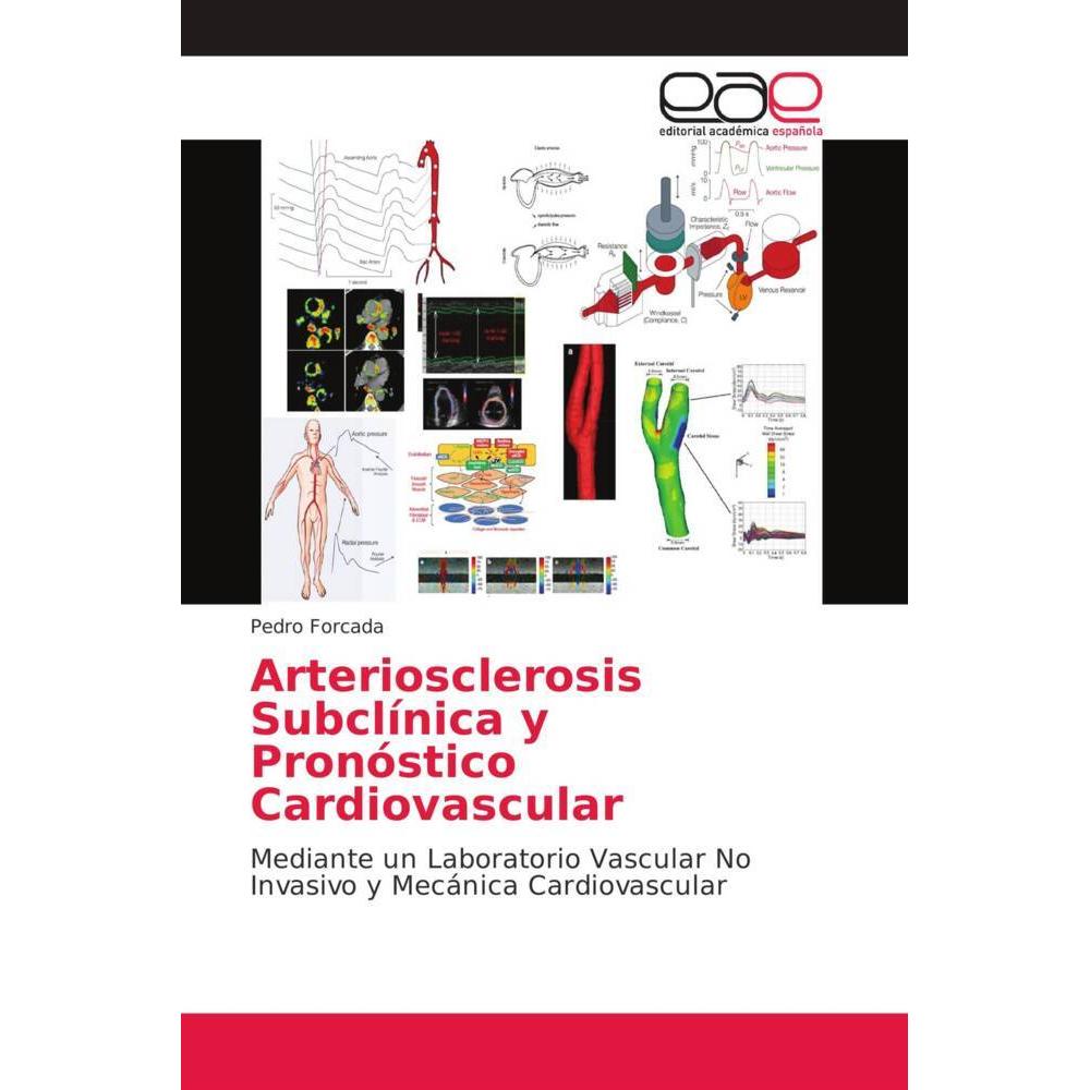 Arteriosclerosis Subclínica y Pronóstico Cardiovascular, Fachbücher von Pedro Forcada
