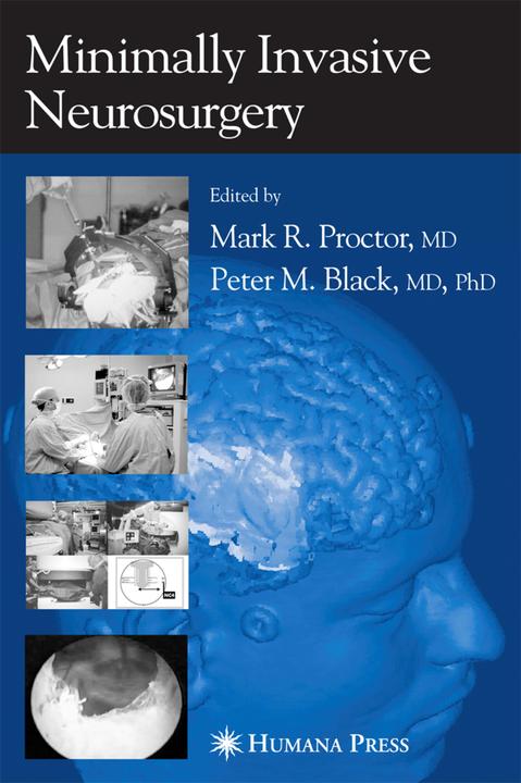 Minimally Invasive Neurosurgery (Mark R. Proctor, 2010)