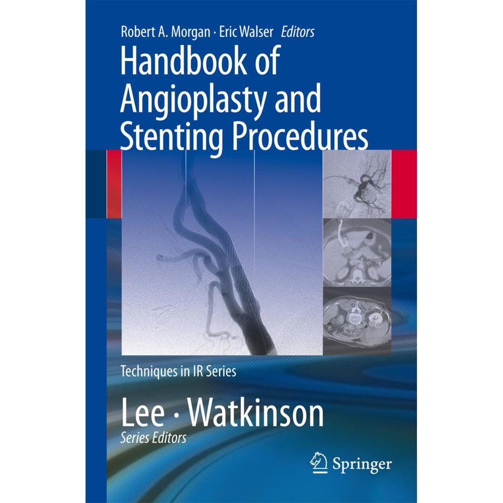 Handbook of Angioplasty and Stenting Procedures, Fachbücher von Robert A. Morgan, Eric Walser