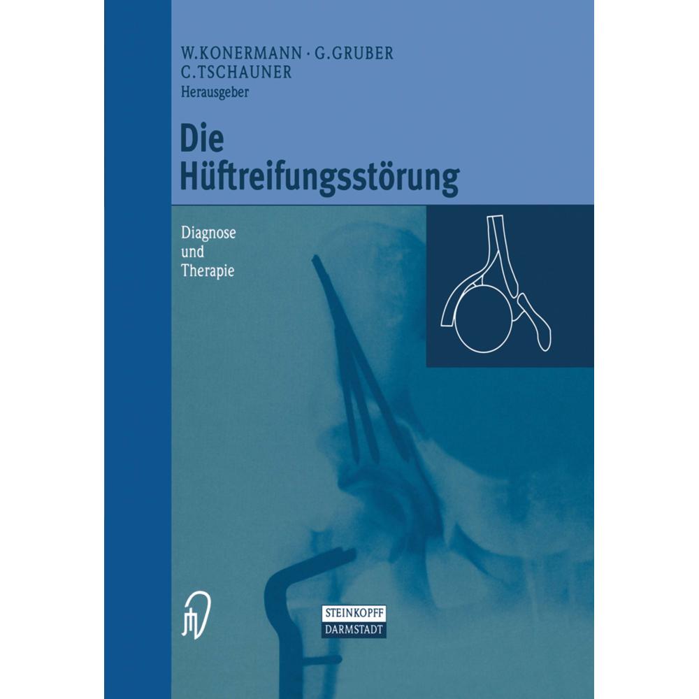 Die Hüftreifungsstörung, Fachbücher von Gerd Gruber, Werner Konermann, Christian Tschauner