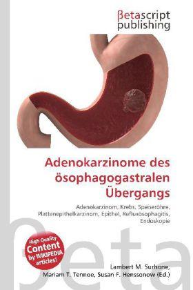 Produktbild Adenokarzinome des ösophagogastralen Übergangs (Deutsch, Lambert M. Surhone, Mariam T. Tennoe, Susan F. Henssonow, 2010)