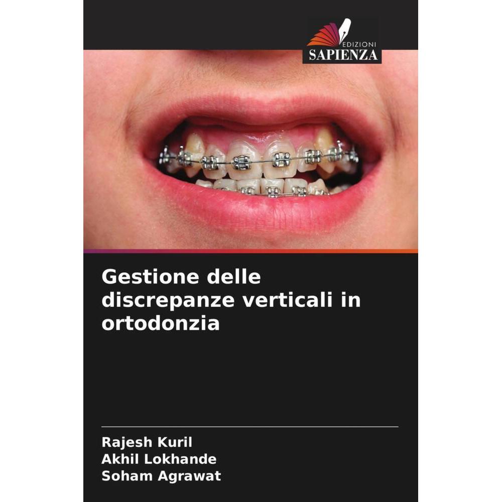 Gestione delle discrepanze verticali in ortodonzia, Fachbücher von Soham Agrawat, Akhil Lokhande, Rajesh Kuril