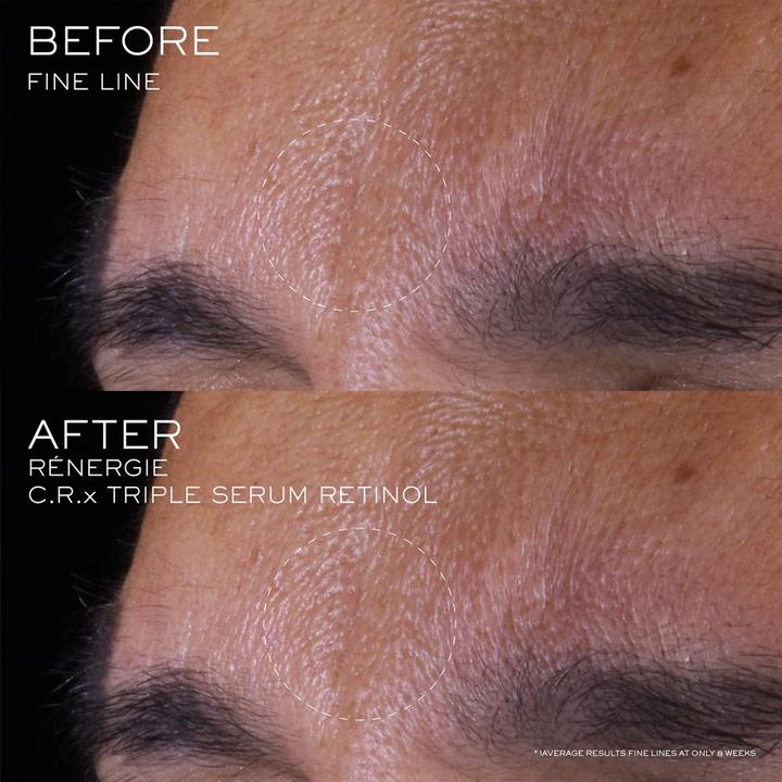 Produktbild Lancôme Rénergie C.R.X. Triple Retinol (50 ml)