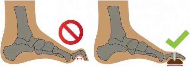Produktbild Bota Podo 26 Links S (S)