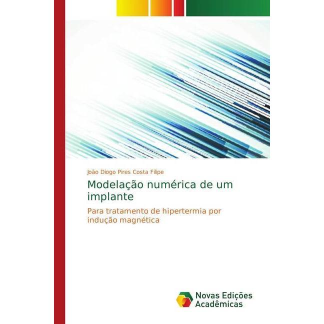 Modelação numérica de um implante, Fachbücher von João Diogo Pires Costa Filipe