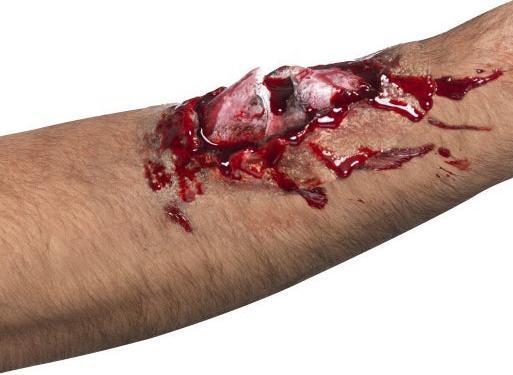 Produktbild Smiffys Wunde mit Knochen - Broken Bone Scar