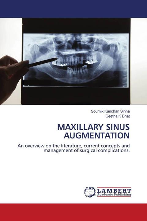 Produktbild Maxillary Sinus Augmentation (Deutsch, Soumik Kanchan Sinha, Geetha K Bhat, 2021)