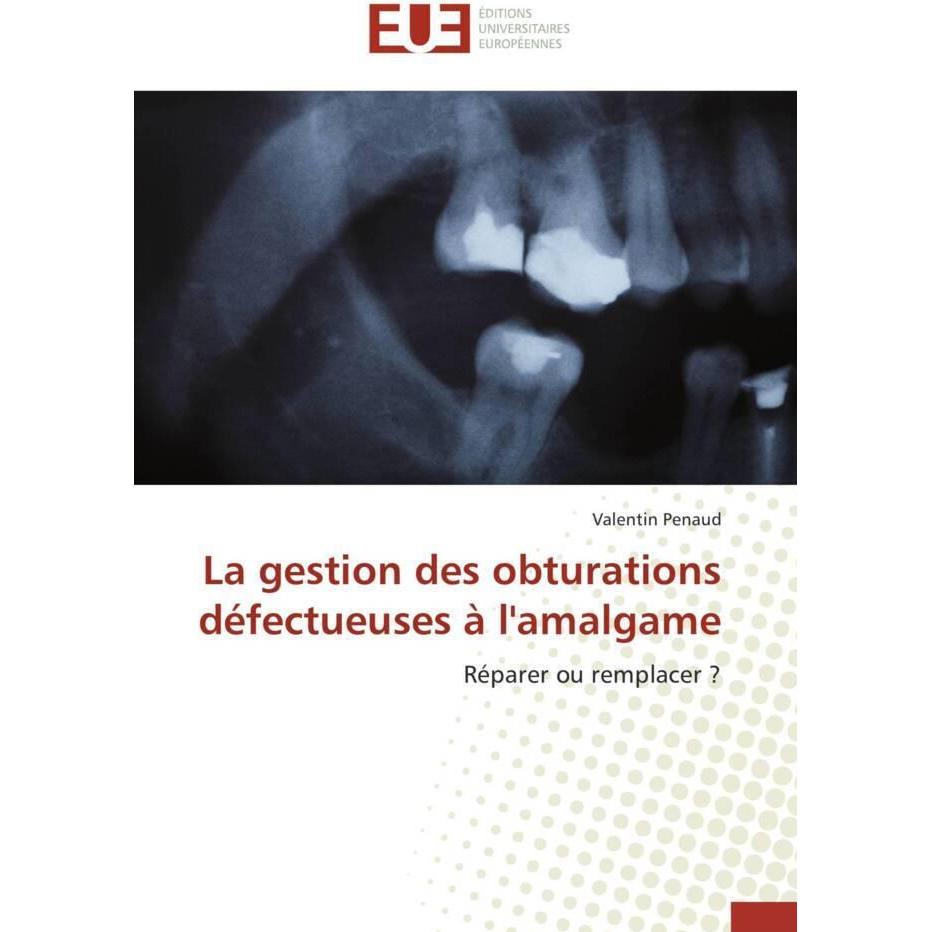 La gestion des obturations défectueuses à l'amalgame, Fachbücher von Valentin Penaud