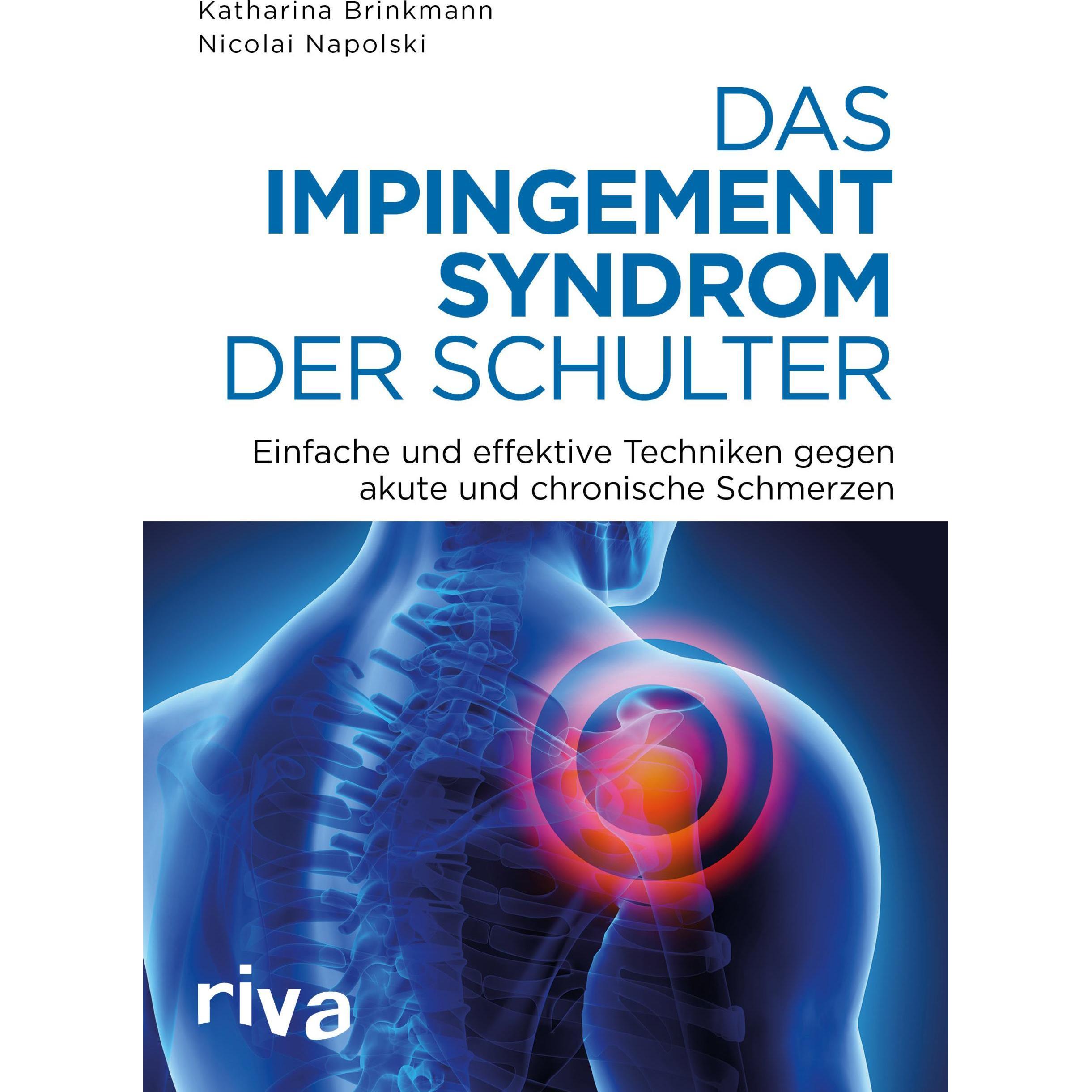 Das Impingement-Syndrom der Schulter, Ratgeber von Nicolai Napolski