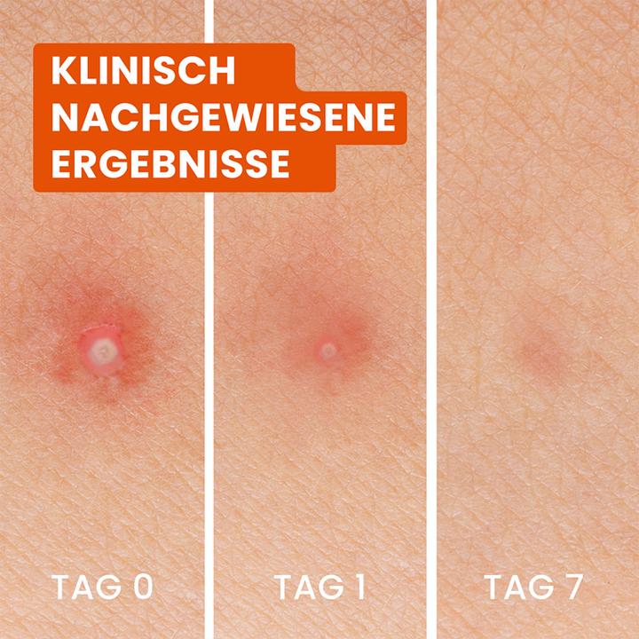 Image du produit Bioré Anti-Pickel (1 ml)