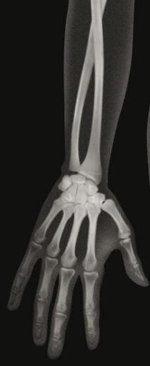 Produktbild Roylco Röntgenbilder Mensch