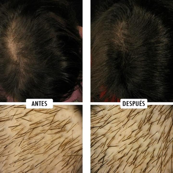 Produktbild The Cosmetic Republic Anti-Haarausfall Cosmetic Republic (30 ml)