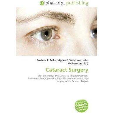 Cataract Surgery, Fachbücher von Agnes F. Vandome, Frederic P. Miller, John McBrewster