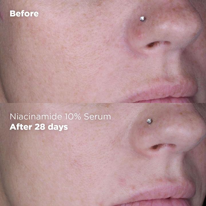 Actual product image Skin Republic - Niacinamide 10% + zinc 1% serum (30 ml)