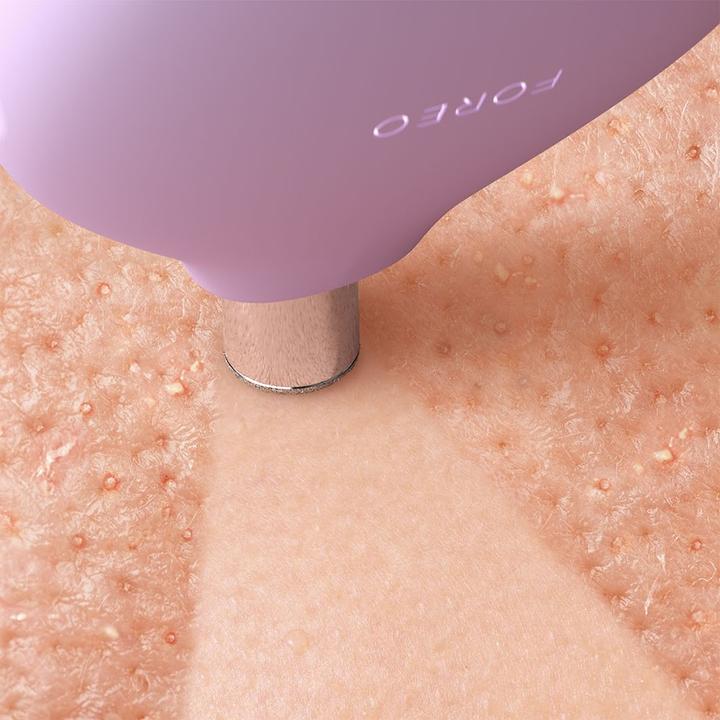 Produktbild Foreo Kiwi Derma