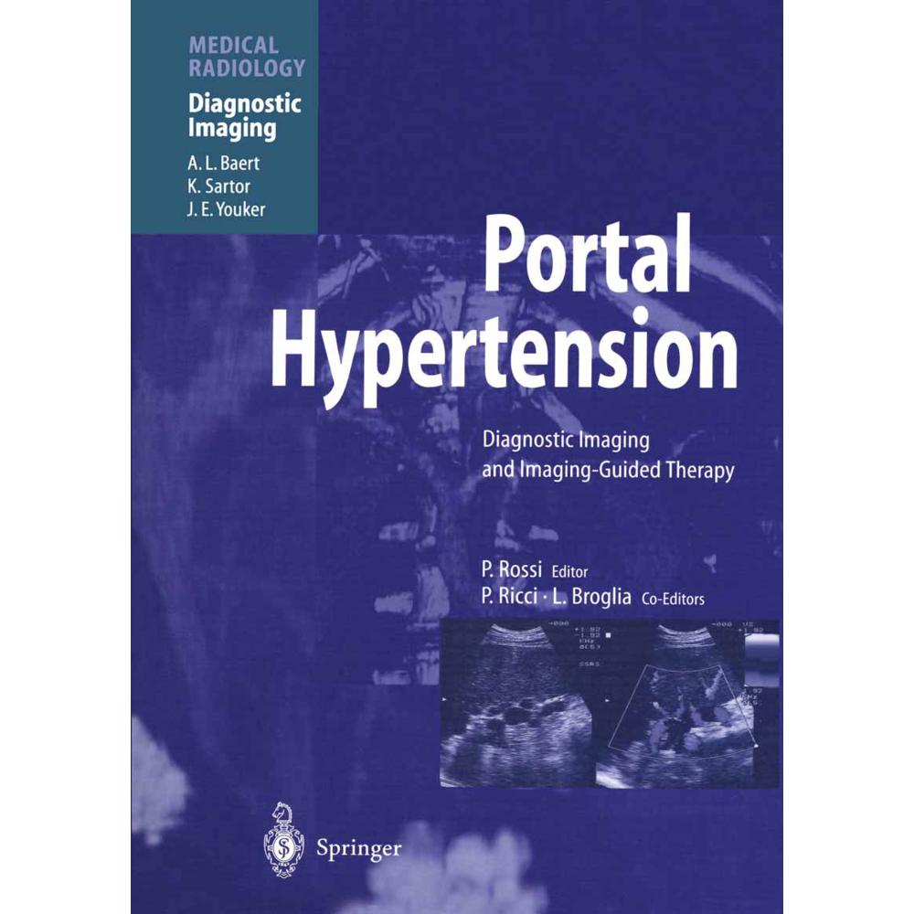 Portal Hypertension, Fachbücher von Plinio Rossi