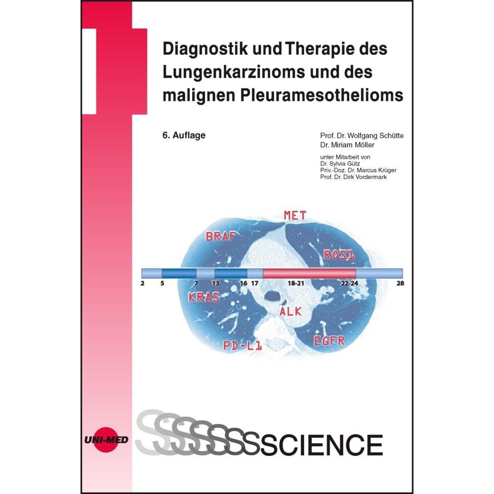 Schütte:Diagnostik und Therapie des Lun, Fachbücher von Wolfgang Schütte, Miriam Möller