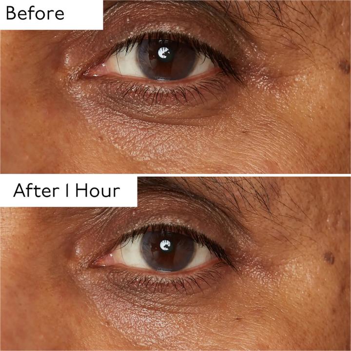Image du produit By Terry Hyaluronic Global Eye Serum (Soin des yeux Sérum, 15 ml)