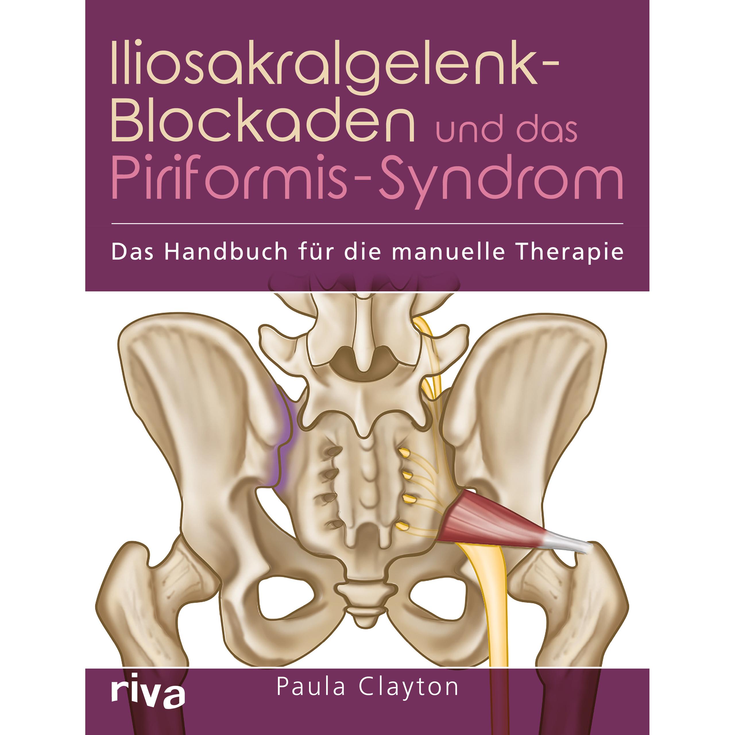Iliosakralgelenk-Blockaden und das Piriformis-Syndrom, Ratgeber von Paula Clayton
