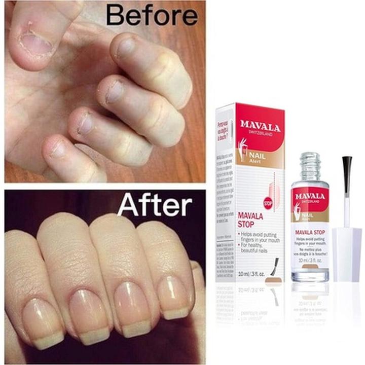 Produktbild Mavala Stop (10 ml)