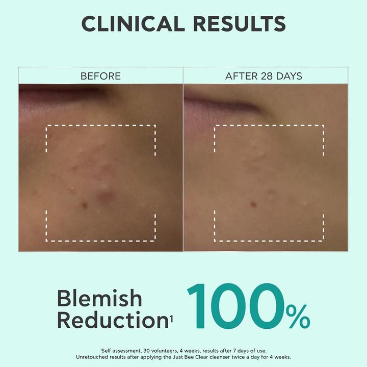 Actual product image Apivita Just Bee Clear Purifying Cleansing Gel For Oily Acne-Prone Skin - 200 Ml (Cleansing gel, 200 ml)