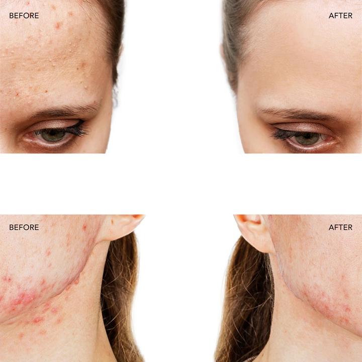 Actual product image Foreo ESPADA 2 Fuchsia