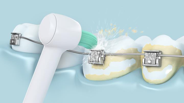 Immagine prodotto Panasonic WEW0984 (Accessori per irrigatori orali)