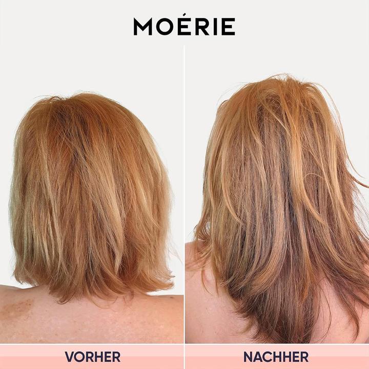 Produktbild Moérie Ultimate Hair Growth (150 ml)