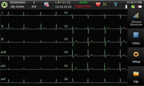 Actual product image Edan Resting ECG SE-301 - Glasgow ECG Analysis, Avec module Wi-Fi