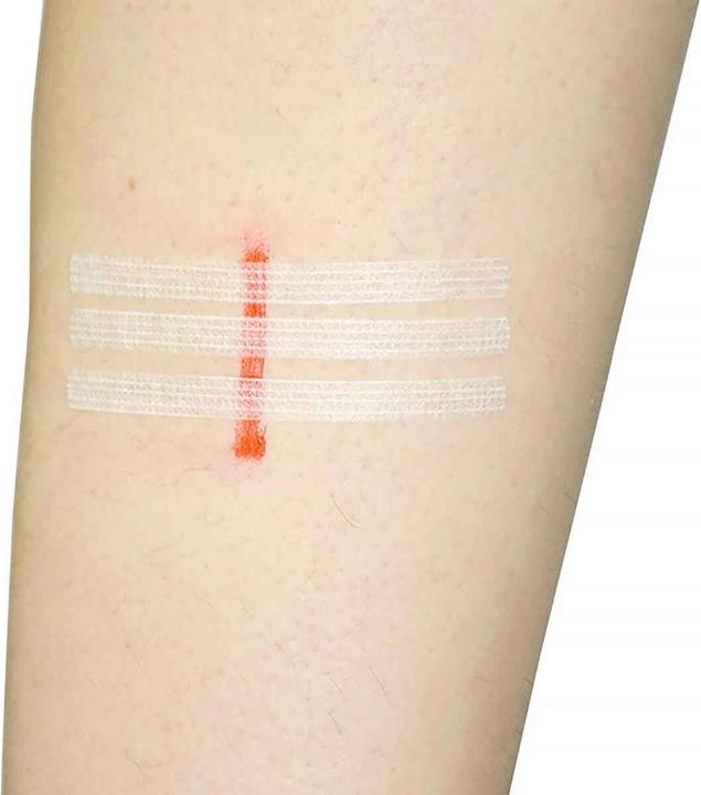 Produktbild Teqler Wundnahtstreifen 6x100mm, 10 Stk (10 x)