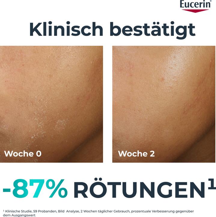 Image du produit Eucerin Dermopure Cl Feuchtigk ther 40ml (40 ml, Crème de jour)