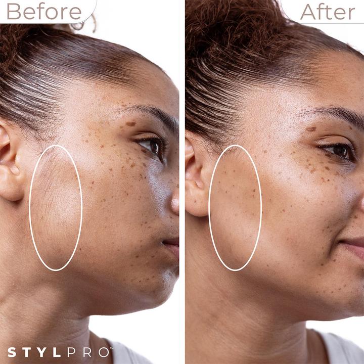 Image du produit Stylideas 2-in1 Sonic Dermaplane