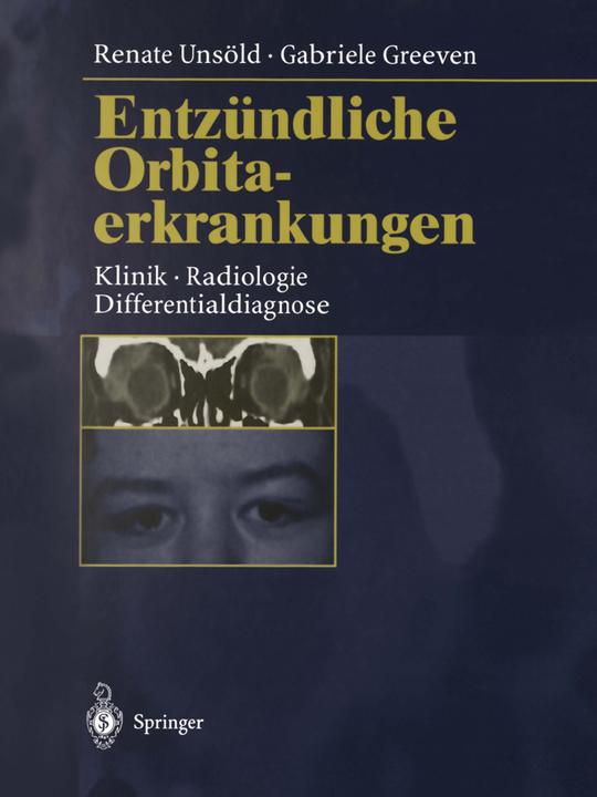 Produktbild Entzündliche Orbitaerkrankungen (Gabriele Greeven, Renate Unsöld, 2014)