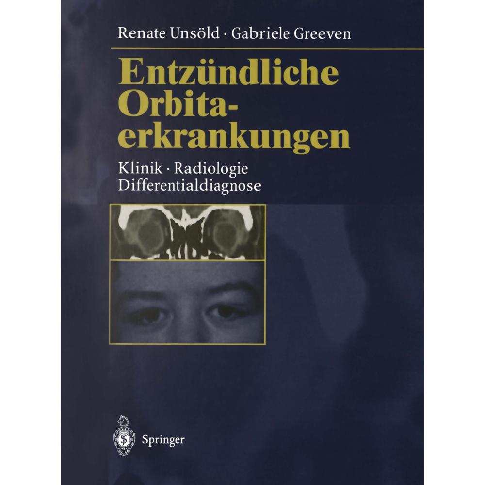 Thumbnail - Entzündliche Orbitaerkrankungen, Fachbücher von Gabriele Greeven, Renate Unsöld