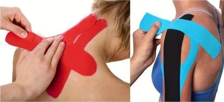 Actual product image Cbx Kinesiology Tape, Sport Tape 5m (5 m)
