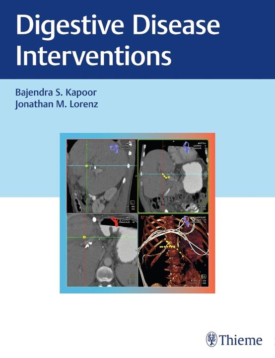 Produktbild Digestive Disease Interventions (Englisch, Baljendra Kapoor, Jonathan M. Lorenz, 2018)