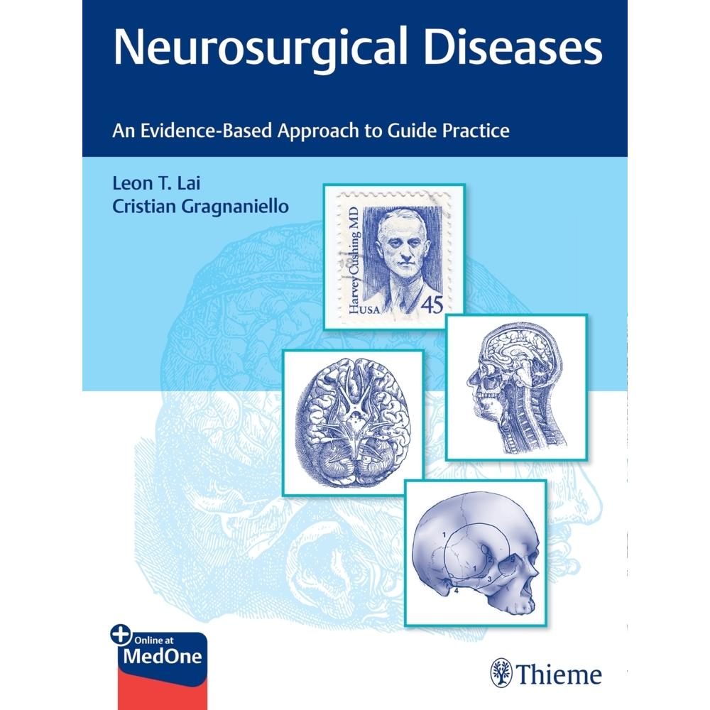 Neurosurgical Diseases, Fachbücher von Cristian Gragnaniello, Leon Lai