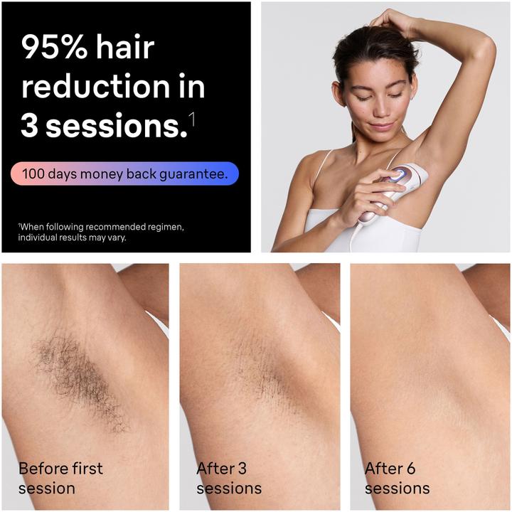 Actual product image Braun Smart IPL Skin i·expert